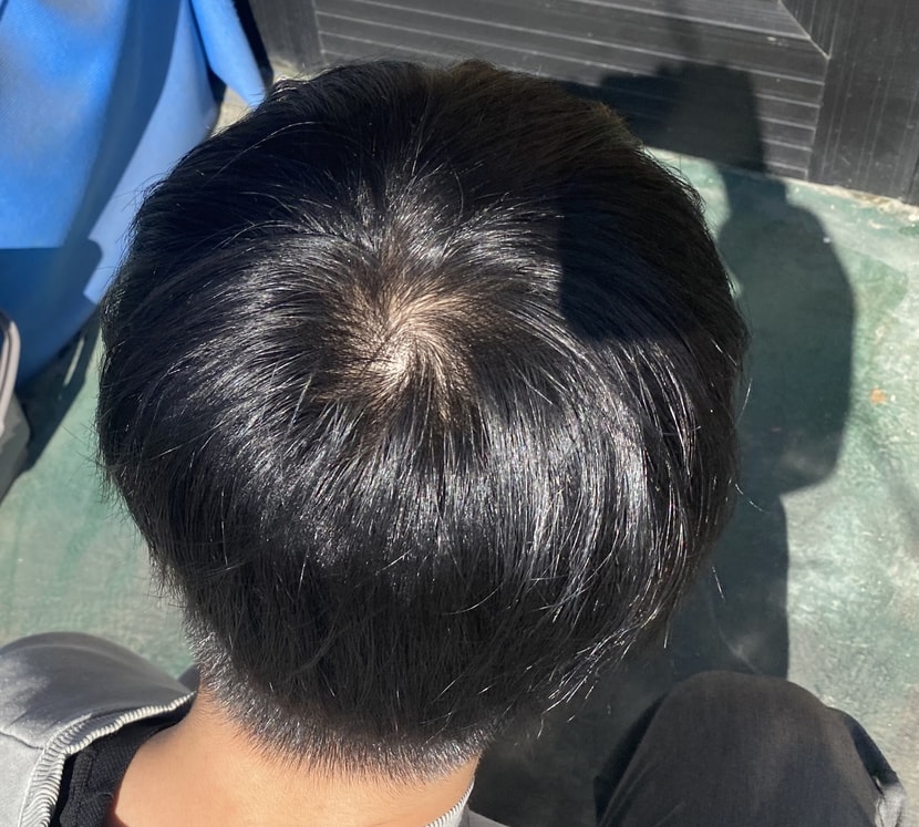땡볕 조명 정통