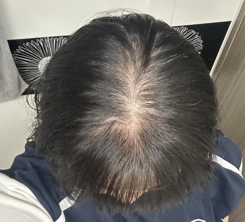 아무래도 진행 중인 거겠죠...?