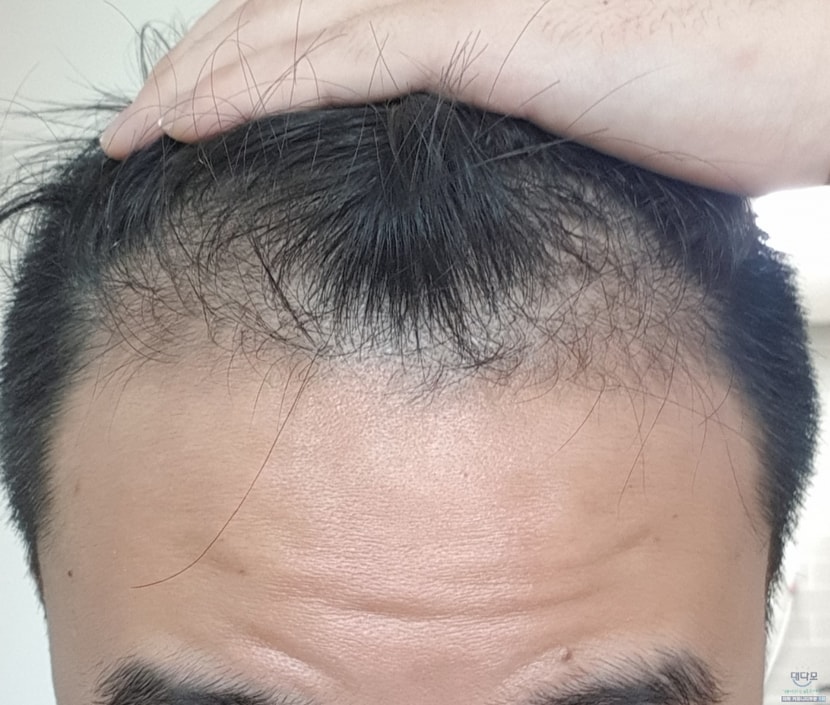 1달차
