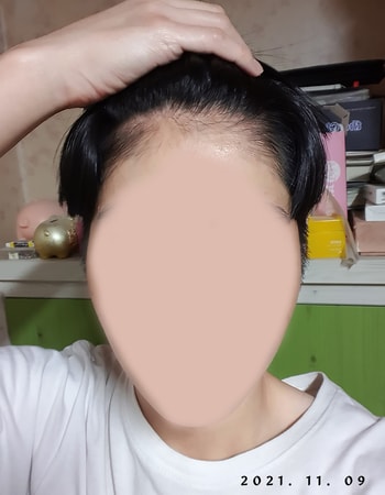 11.9일