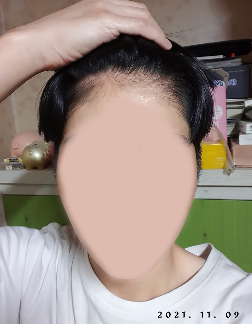 11.9일