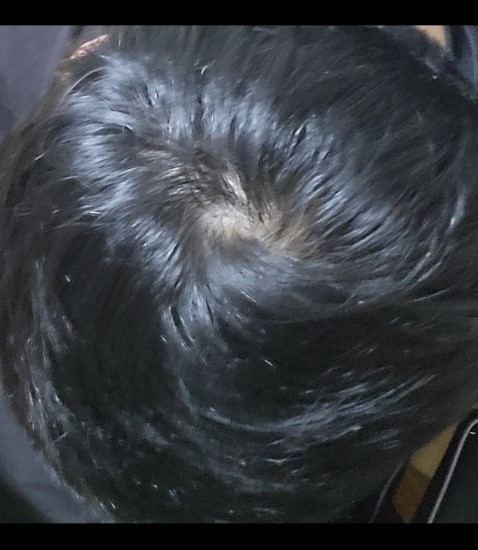 1년 전 사진입니다.
