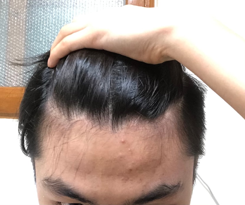 현재