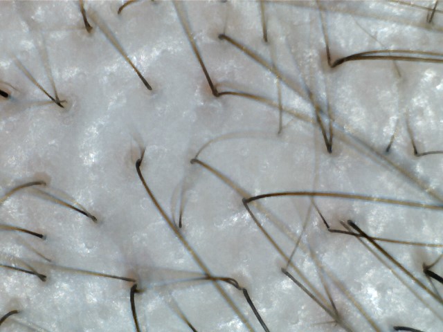 이마3