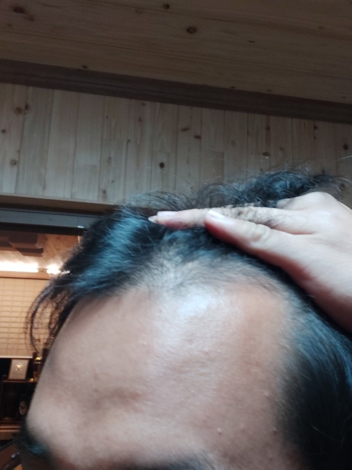 2020년 오른쪽 M자