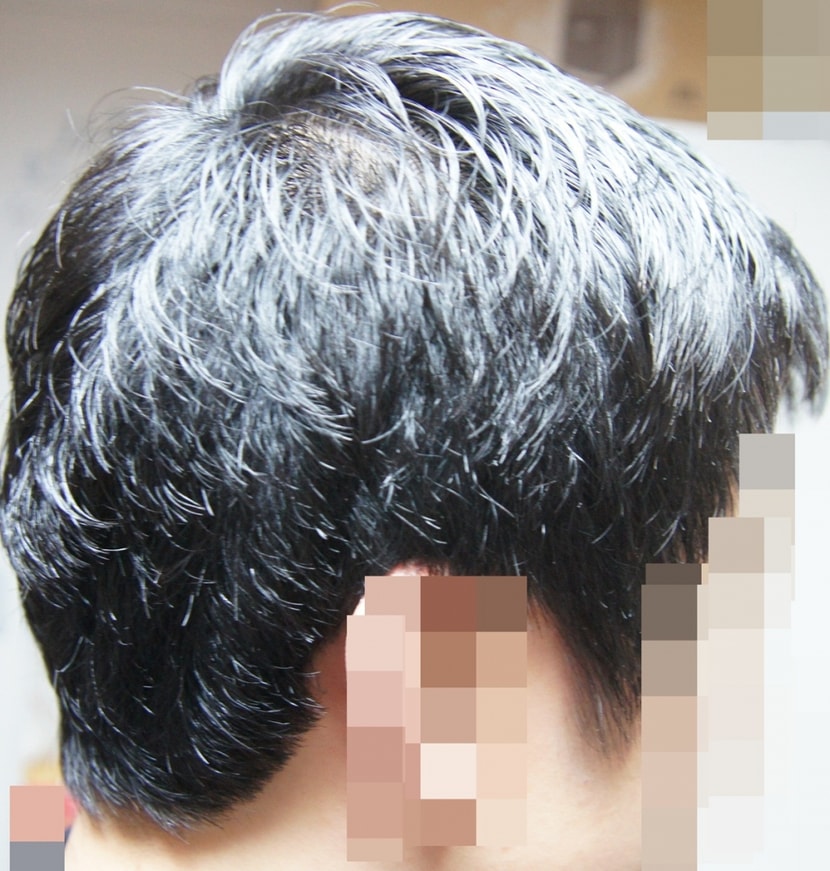 올해 12월 호전된 모습입니다