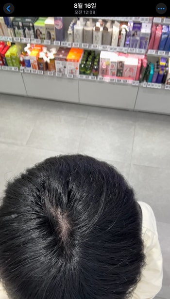 1년전 머리빠지는게 없던 시절 