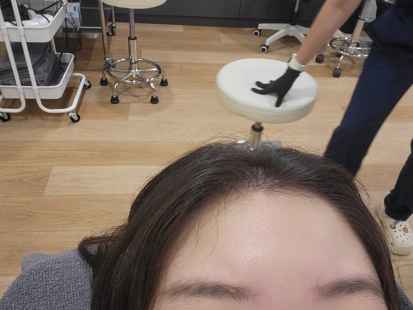 치료받기전의 제 머리 입니다!!