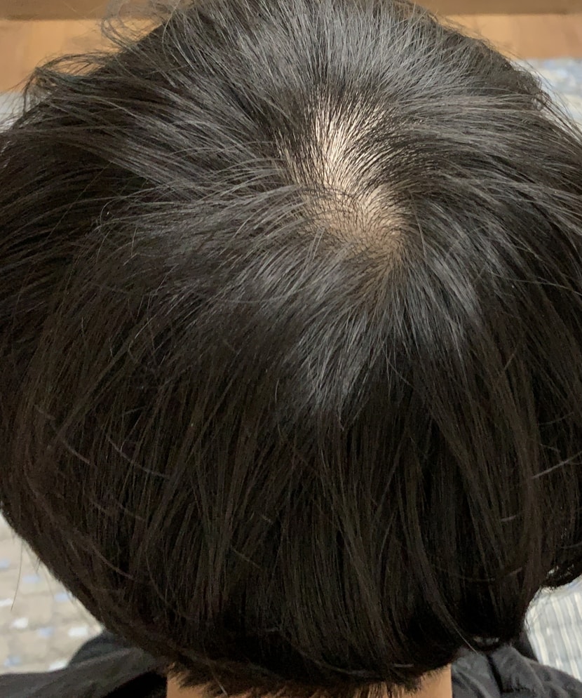 현재 뒤
