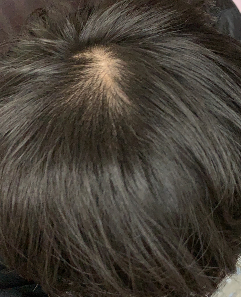 앞