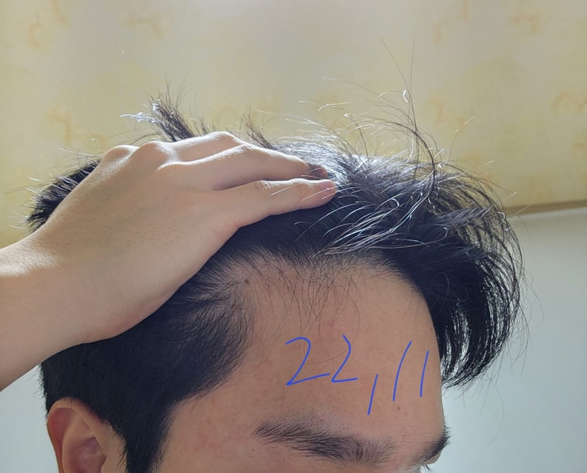 2년전