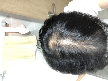 한달 전 가르마 라인