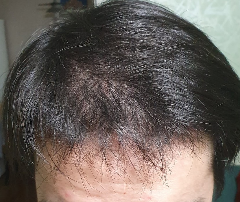 정면