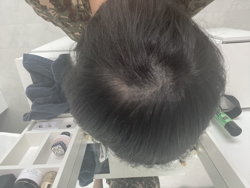 정수리