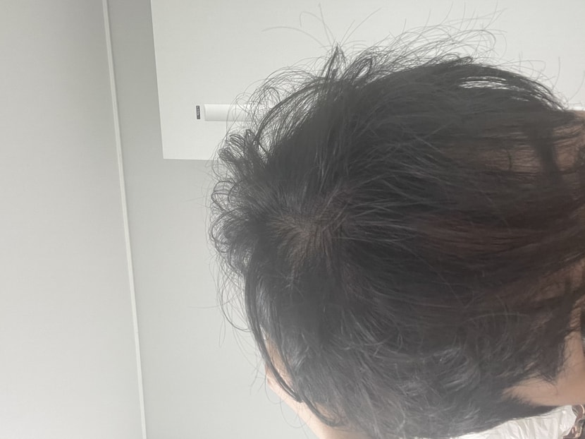 앞통수