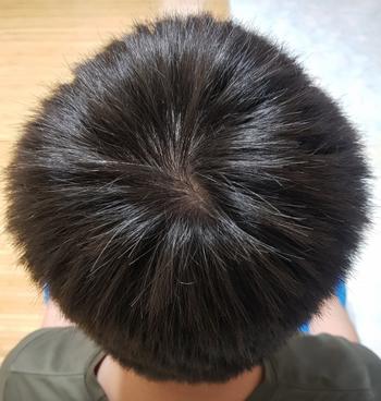 정수리 머리 말린직후 이발 전