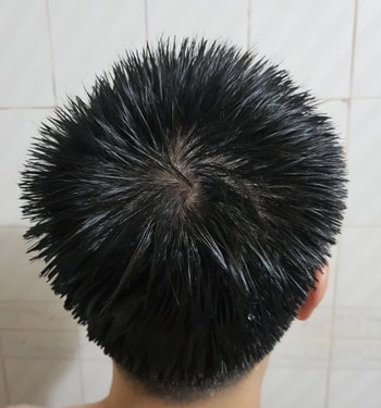 정수리 이발 후