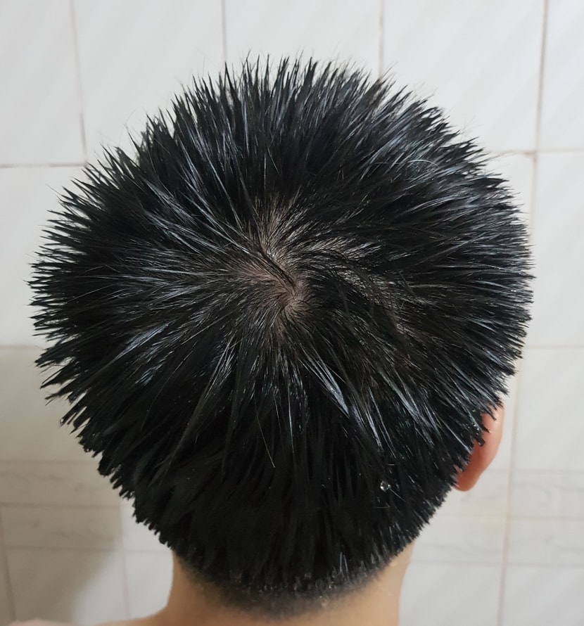 정수리 이발 후