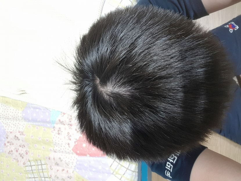 23년 6월 5일 윗머리 사진2