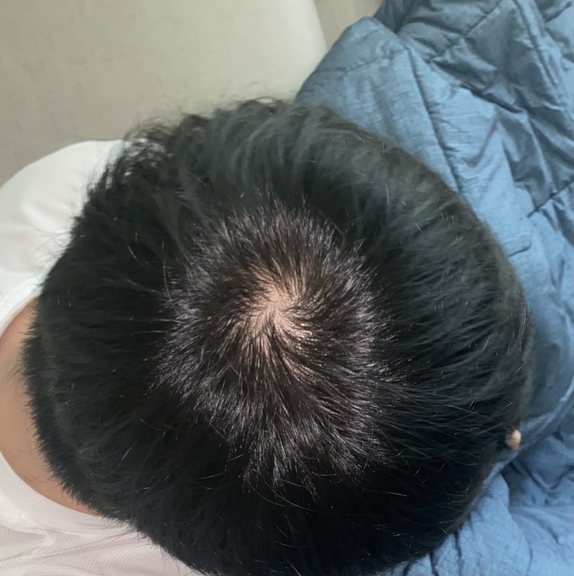 오늘