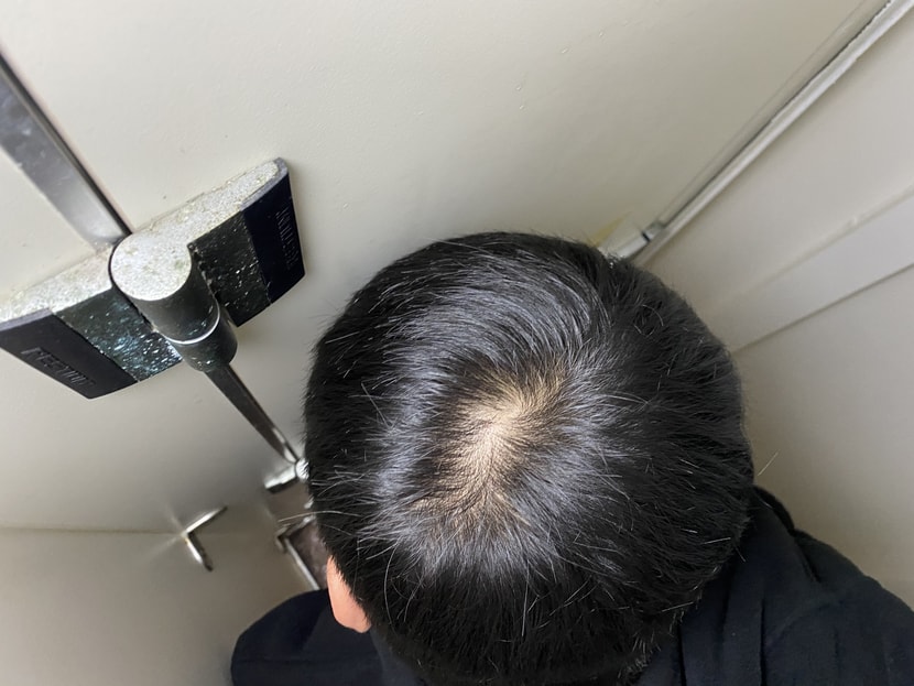 약먹기 시작햇을때
