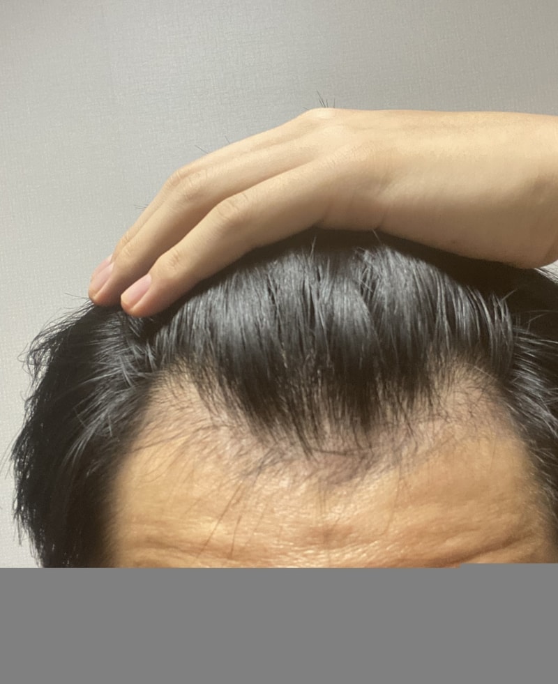 Could the shading be coming in 6 months??