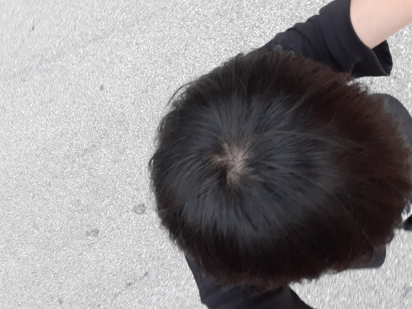 정수리