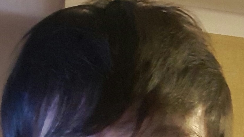 내렸을때 엠자부분뿐만아니라 앞머리전부가 갈라짐