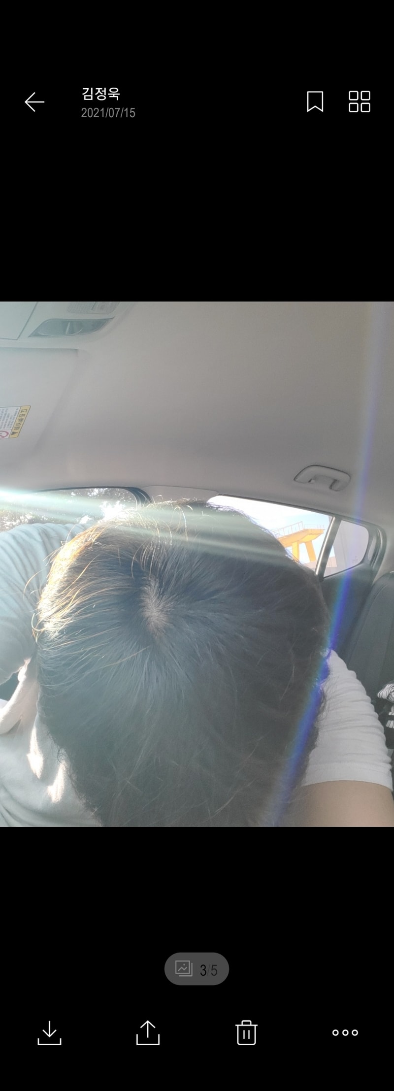 미녹시딜 쉐딩 원래이렇게 심한가요