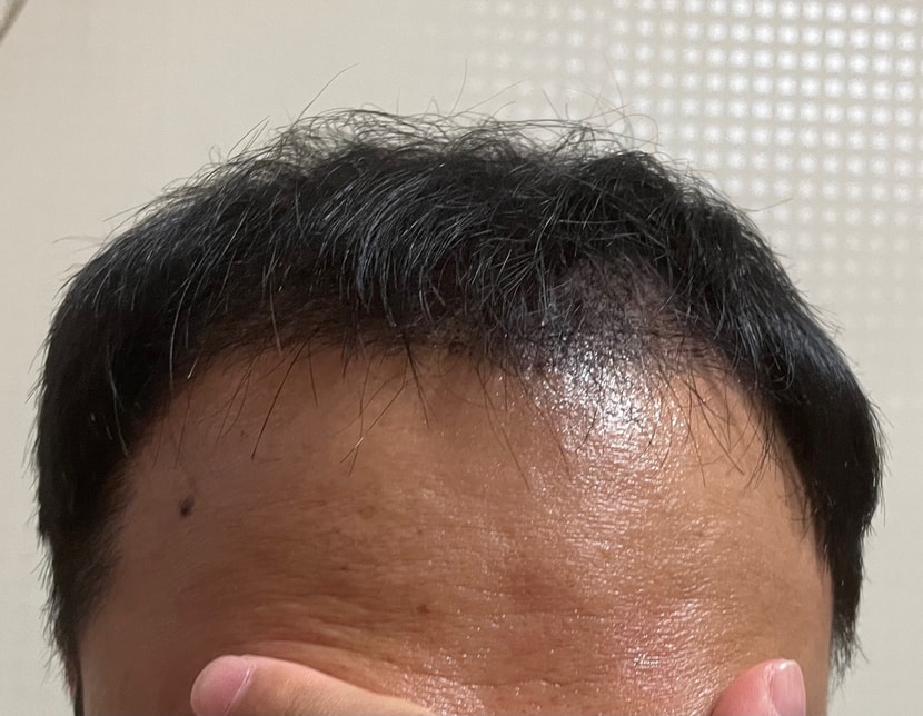두번쨰