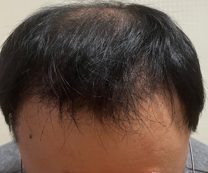 첫번째