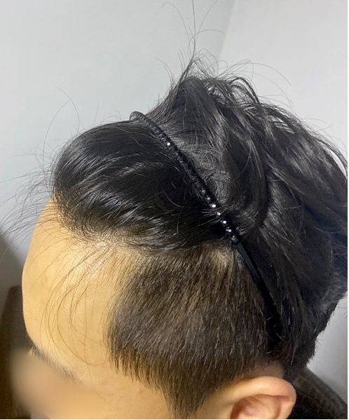 수술하기 전