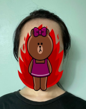 수술 전 사진 1