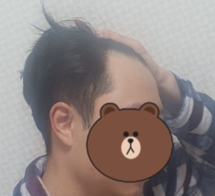 Before