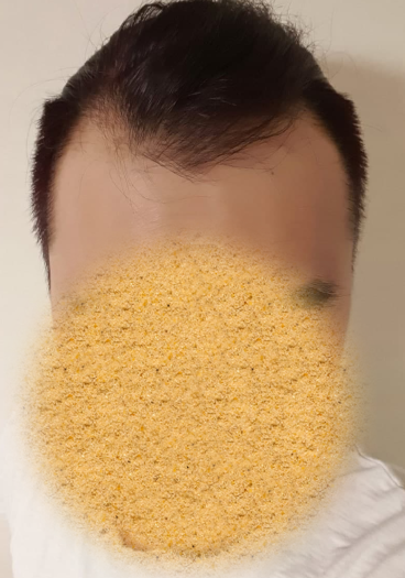 수술하기 전