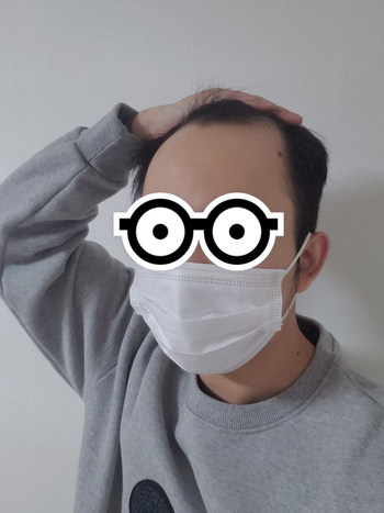 전