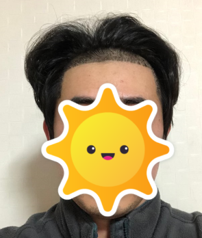 후