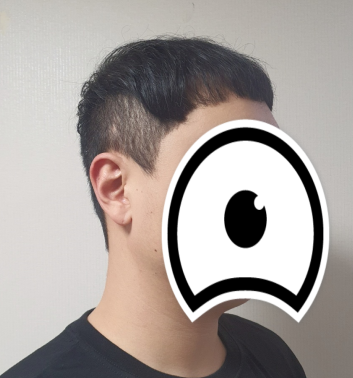 수술후 (우측)