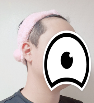 수술전 (우측)