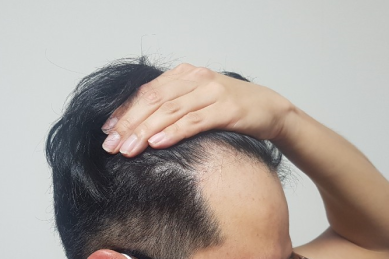 수술 전