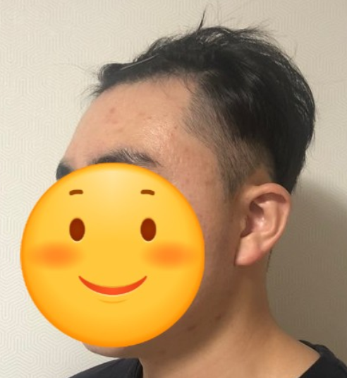 수술전 사진