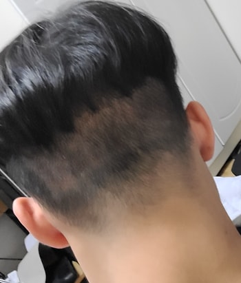 수술 후 사진