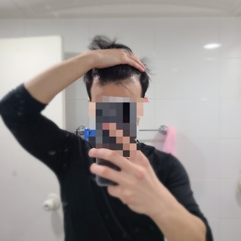 수술 전 사진
