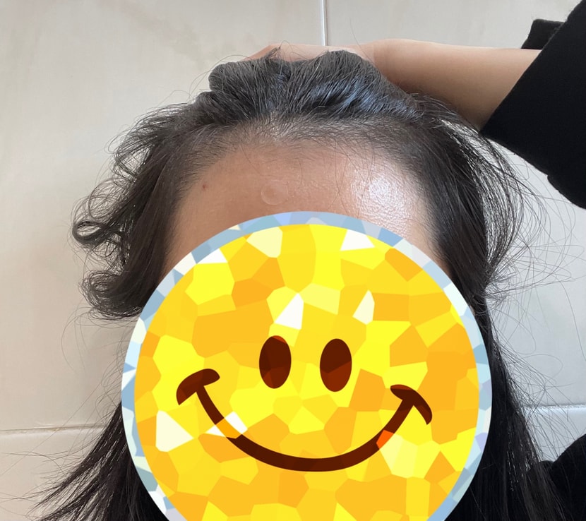 후