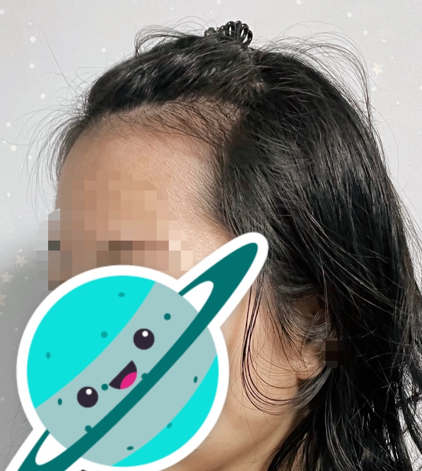 전