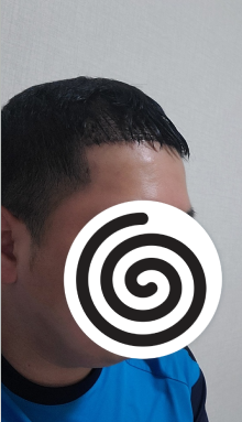 수술 후 사진입니다
