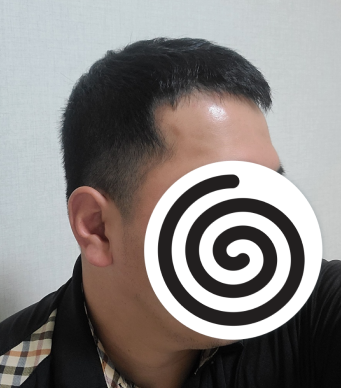 수술 전 사진입니다