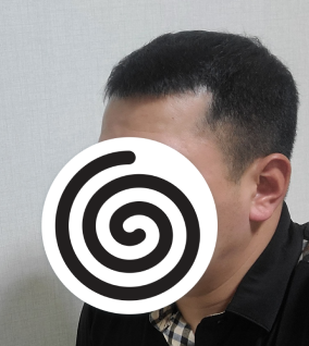 수술 전 사진입니다