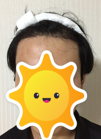 오늘 오전에 찍은 머리입니다