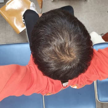 복약 1년 5개월